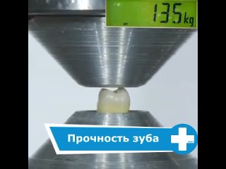 chip key tooth strength in kg